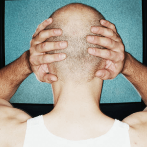 calvicie-y-depresion