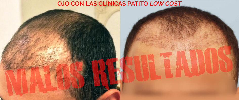 ¡Cuidado con las clínicas patito low cost!