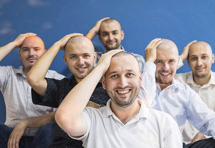 Calvicie prematura en los Millennials I