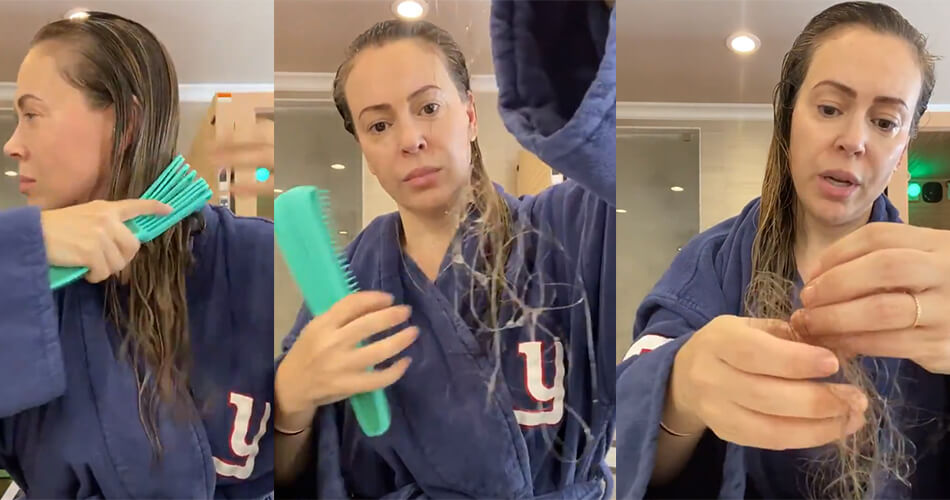 Otra secuela más del COVID-19: caída del cabello