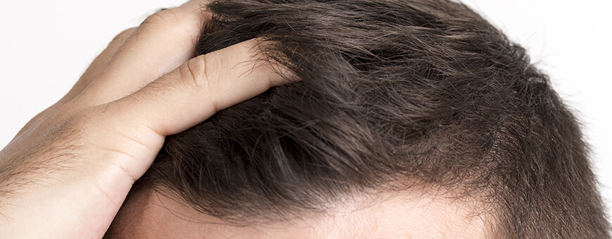 Todo sobre los folículos pilosos